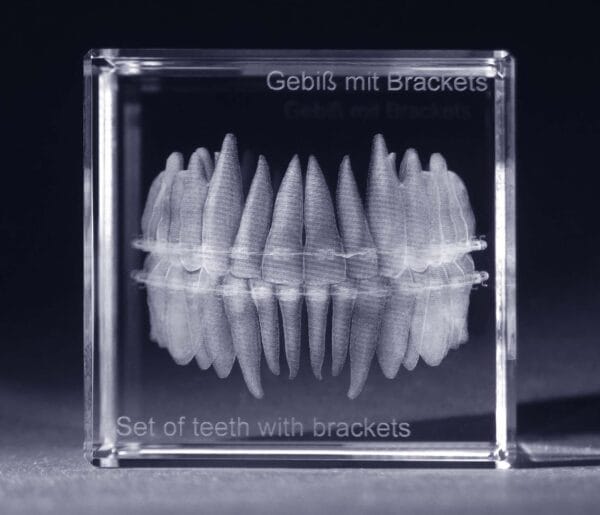 Tänder med tandställning - 3D Kristall skapad av Crafted In Crystal