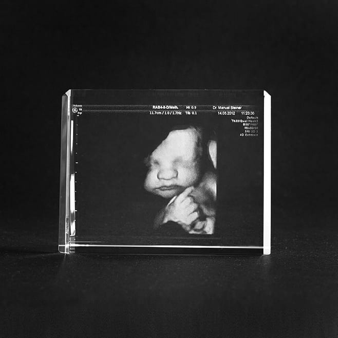 2D-sonogram