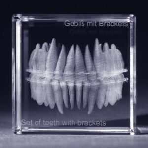 Tänder med tandställning anatomi motiv 3D Kristall