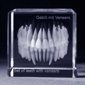 Tänder med veneers anatomi motiv 3D Kristall